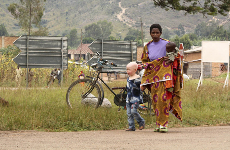 Un niño albino en Burundi An woman walks with her albino son to a courtroom in Ruyigi, eastern Burundi, May 28, 2009. Prosecutors in Burundi on Thursday asked for life sentences for three people on trial for allegedly murdering albinos to sell their body parts for use in witchcraft. REUTERS/Jean Pierre Aime Harerimana (BURUNDI CRIME LAW SOCIETY) 50/afr11/cordon press