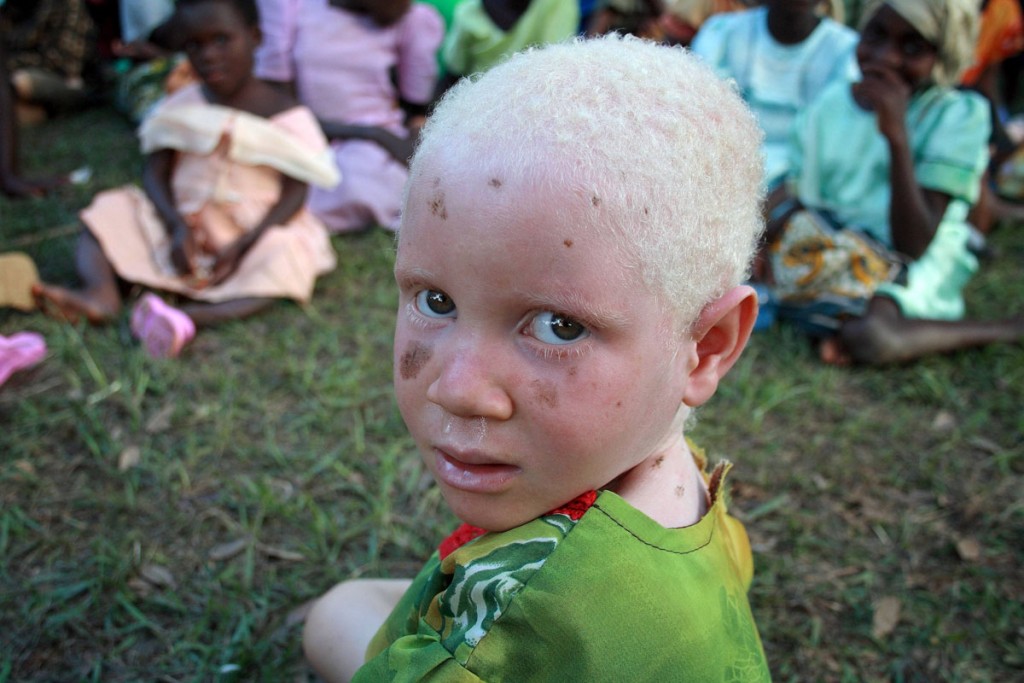 An albino child poses at a picnic organised by the Tanzania Red Cross Society (TRCS) at the government-run school for the disabled in Kabanga, in the west of the country near the town of Kigoma on Lake Tanganyika June 5, 2009. The school began to take in albino children late last year after albinos were being killed in Tanzania and neighbouring Burundi by people who allegedly sell their body parts for use in witchcraft. There are now nearly 50 albino children sheltering in Kabanga with their mothers. The school has now completely run out of space, but vulnerable albinos are still being brought in by the police from as much as 200 kilometres away. The Tanzanian government said recently it would take steps to fast-track murder trials involving the killing of albinos. Picture taken June 5. REUTERS/Alex Wynter/IFRC/Handout    (TANZANIA CONFLICT SOCIETY) FOR EDITORIAL USE ONLY. NOT FOR SALE FOR MARKETING OR ADVERTISING CAMPAIGNS