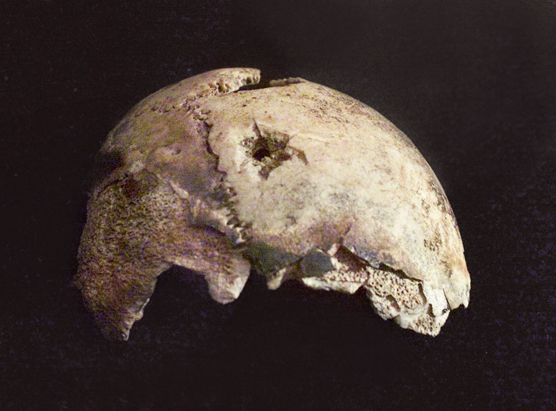 los restos de hitler, mandibula autentica (2)