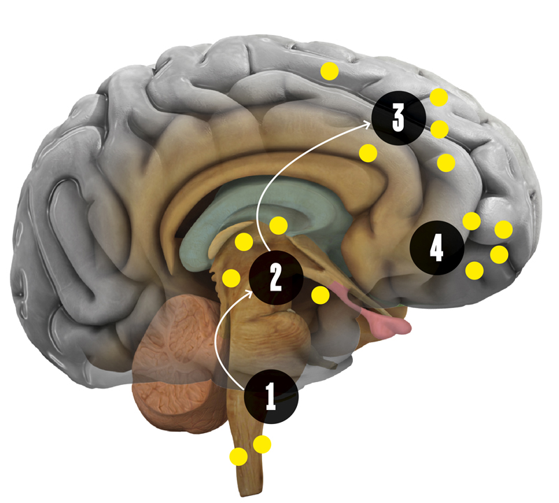 parkinson-cerebro